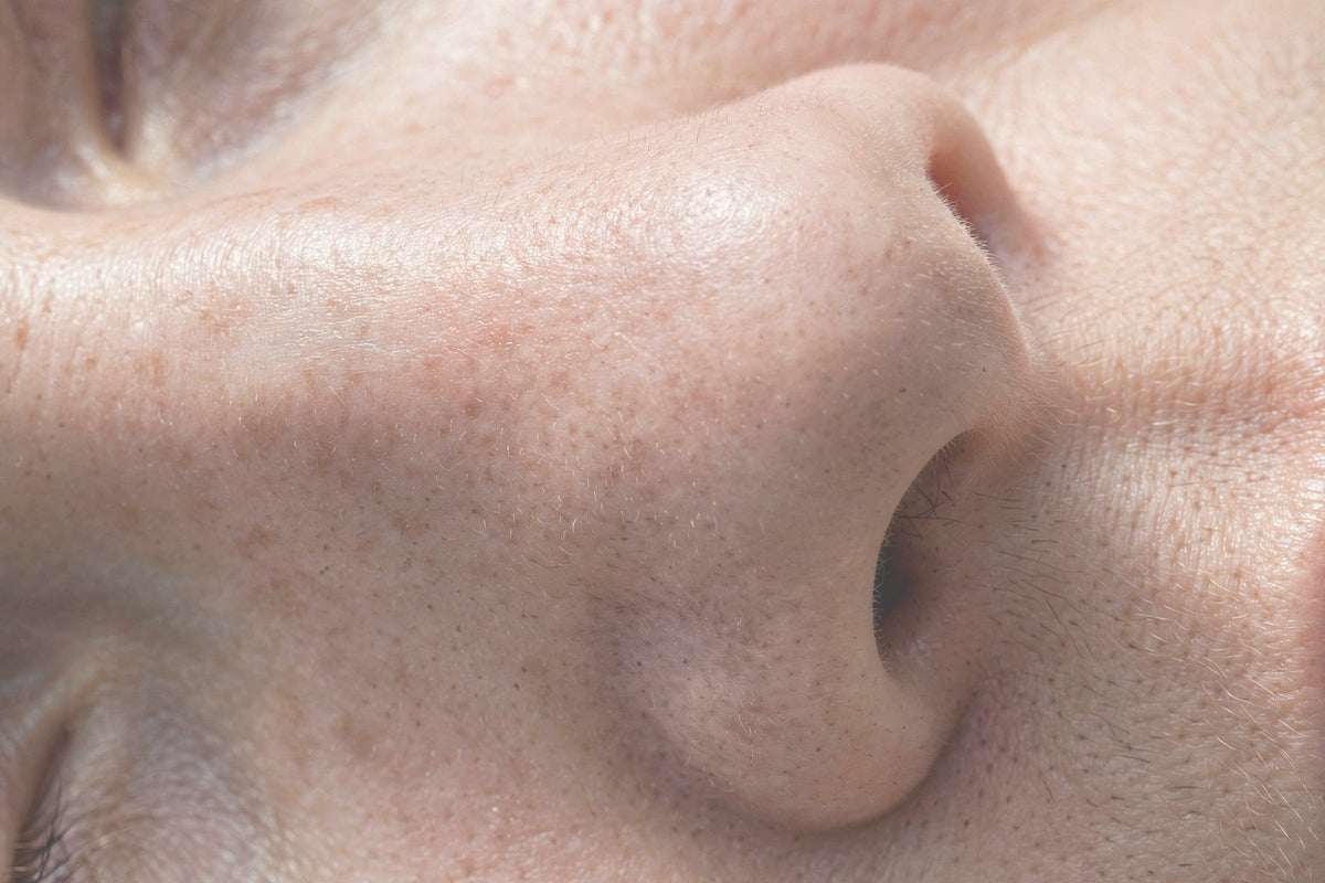 Blackheads and sebaceous filaments on the nose — close-up — OrOrgani