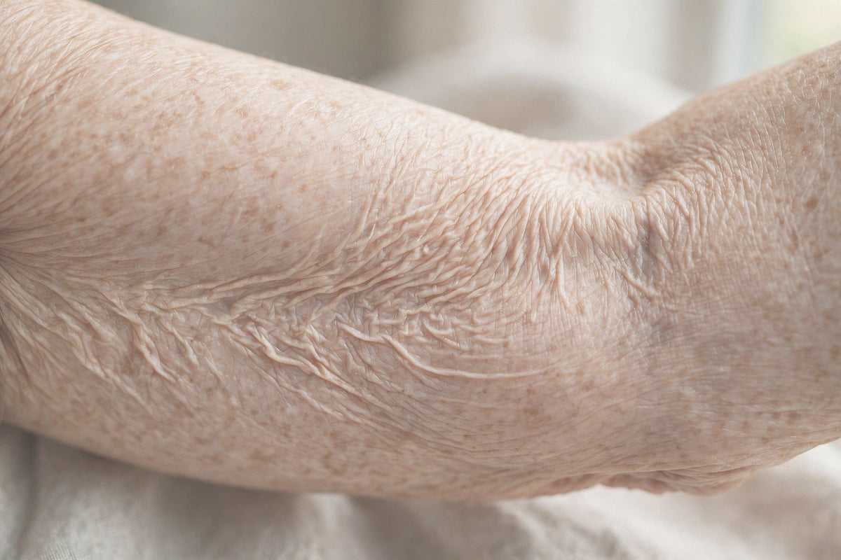 Crepey skin on the inner arm — close-up — OrOrgani