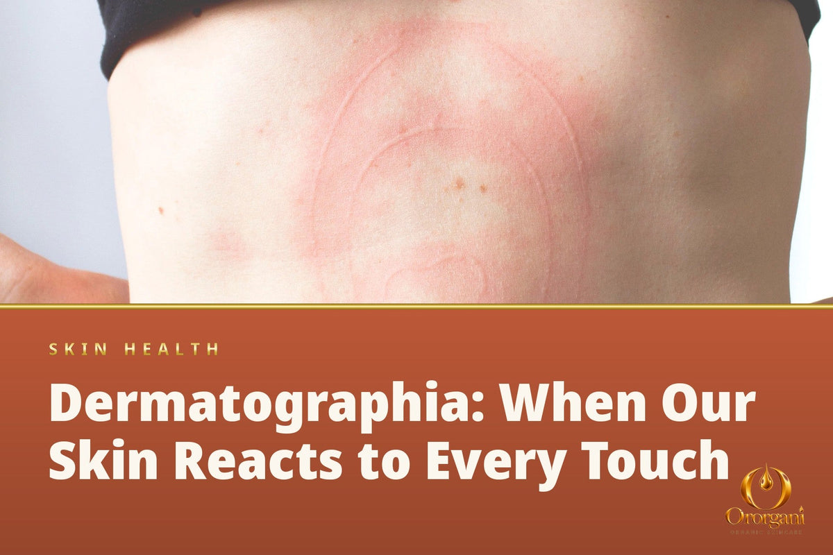 Dermatographia — When Our Skin Reacts to Every Touch