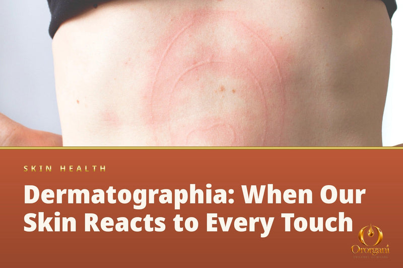Dermatographia — When Our Skin Reacts to Every Touch