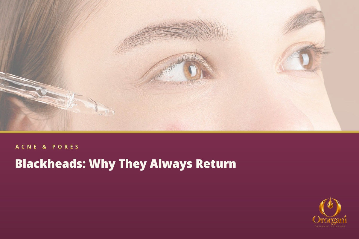 You Clean the Blackheads from Your Nose, but Why Do They Always Come Back?