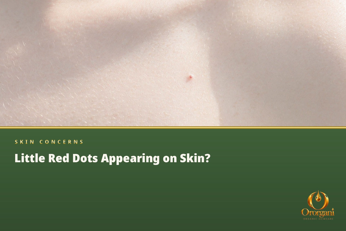 The Small Red Dots That Begin to Appear on the Body – What Do They Mean?