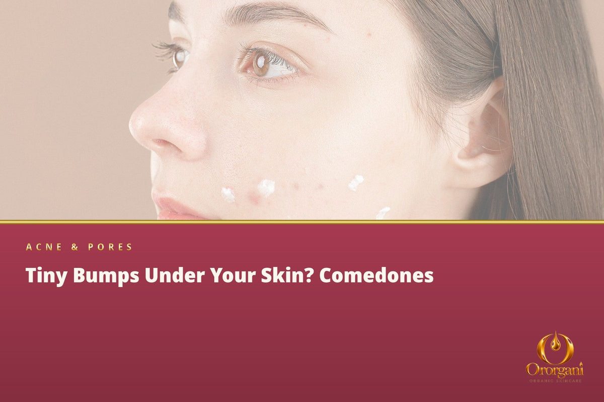The Small Bumps You Feel When You Run a Hand over Your Face – What Are They?