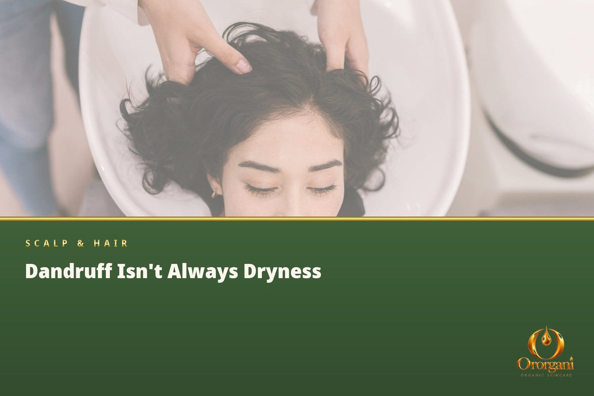Dandruff on the Scalp – Why It Appears, How to Prevent It, and What Really Helps Get Rid of It?