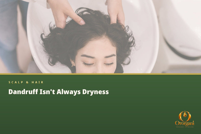 Dandruff on the Scalp – Why It Appears, How to Prevent It, and What Really Helps Get Rid of It?