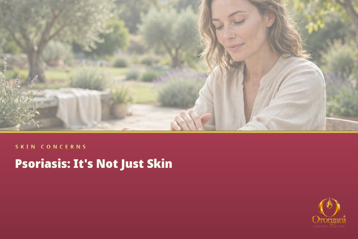 Psoriasis: Much More Than a Skin Disease — The Connection to the Immune System, the Gut, and Lifestyle
