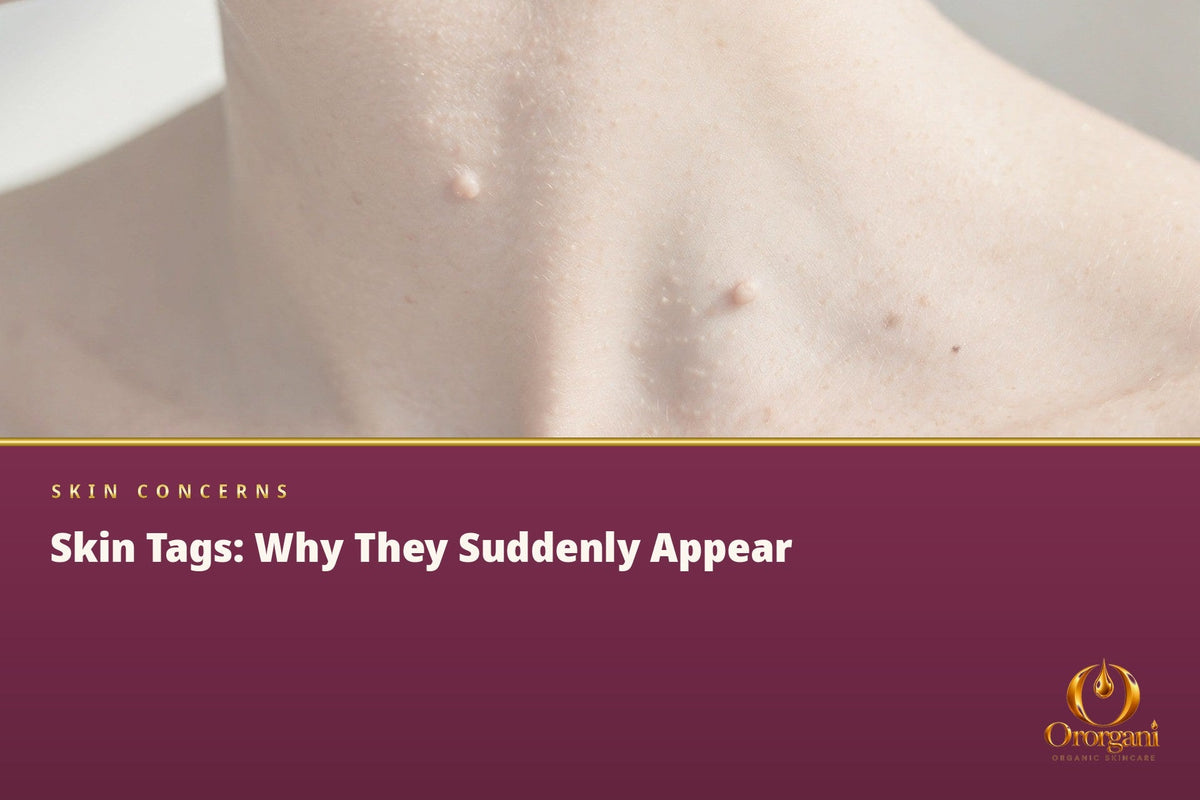 The Small Bumps on the Neck That Weren't There Before – Why Do They Appear?