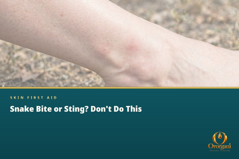 Snake Bite, Scorpion Sting or Animal Bite – The Mistakes Not to Make in the First Moments