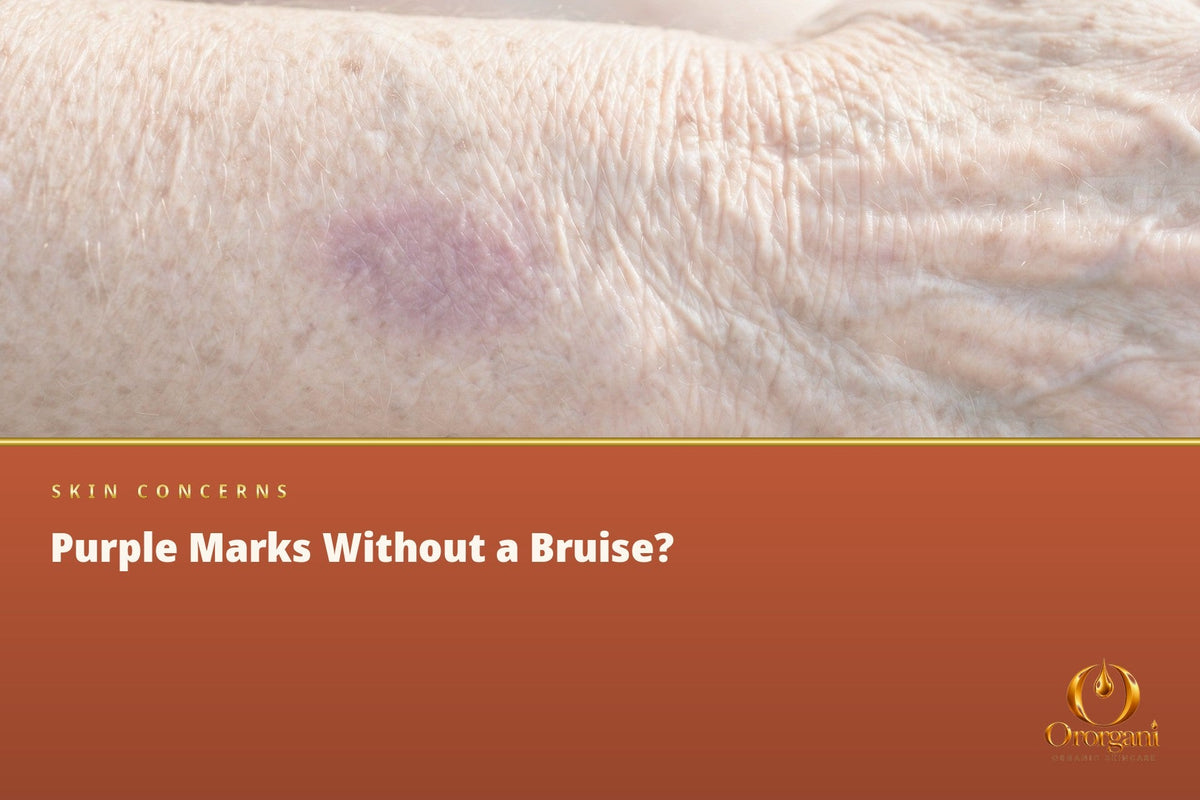 Why Do Purple Marks Appear on the Hands Even Without Remembering a Blow?
