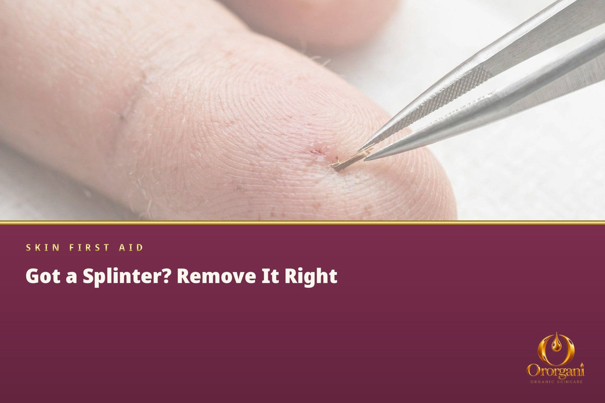 A Splinter in the Skin – How to Remove It Correctly and When It's Better Not to Touch
