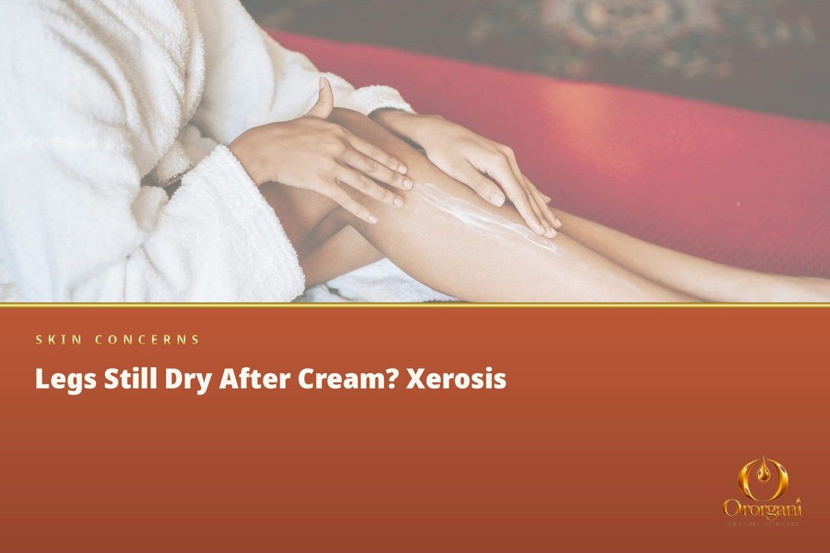 Why Do the Legs Get So Dry, Even When We Apply Cream?